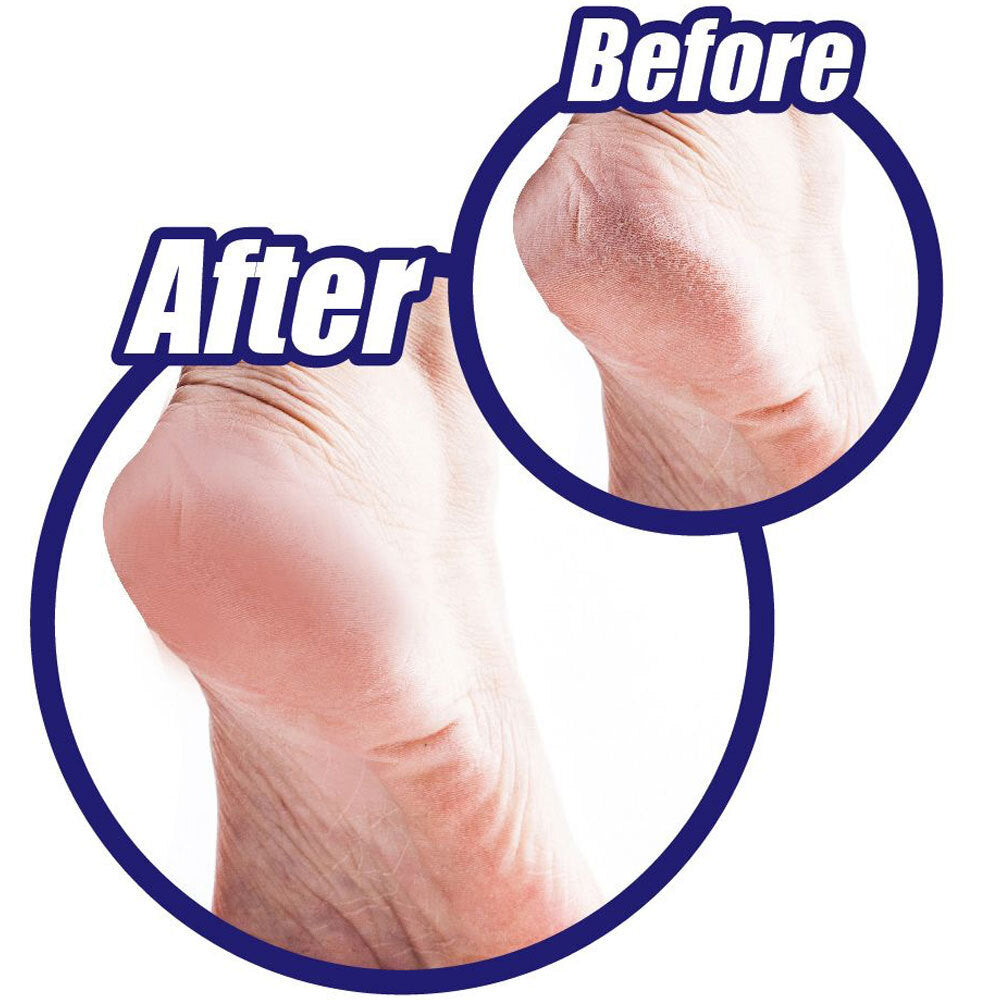 81889-loraine-shower-scrubby-feet-cleaner-36cm